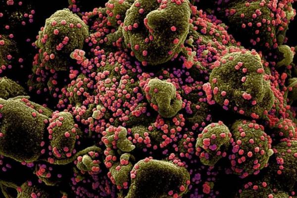Inilah Faktor Penyebab Tingginya Angka Kematian Virus Corona di Indonesia