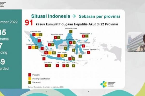 Jubir Kemenkes dr Syahril: Ada 35 Kasus Probable Hepatitis